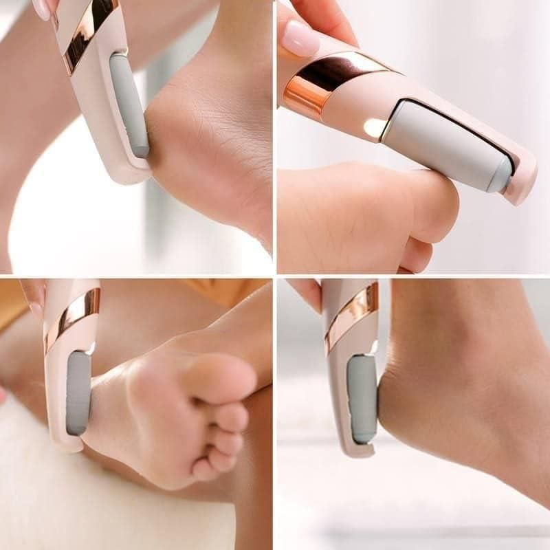Electronic Dead Skin Remover